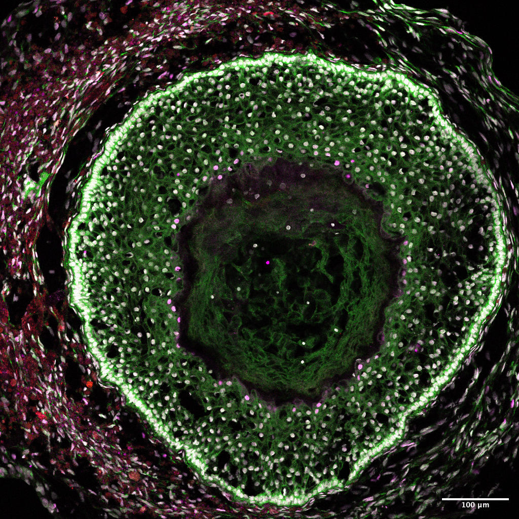 6439942b0d1d9fc1b9473302_2022-11-12_hOvaroids_day70_Alif - NR5_20X_1_rescan2_composite | Gameto