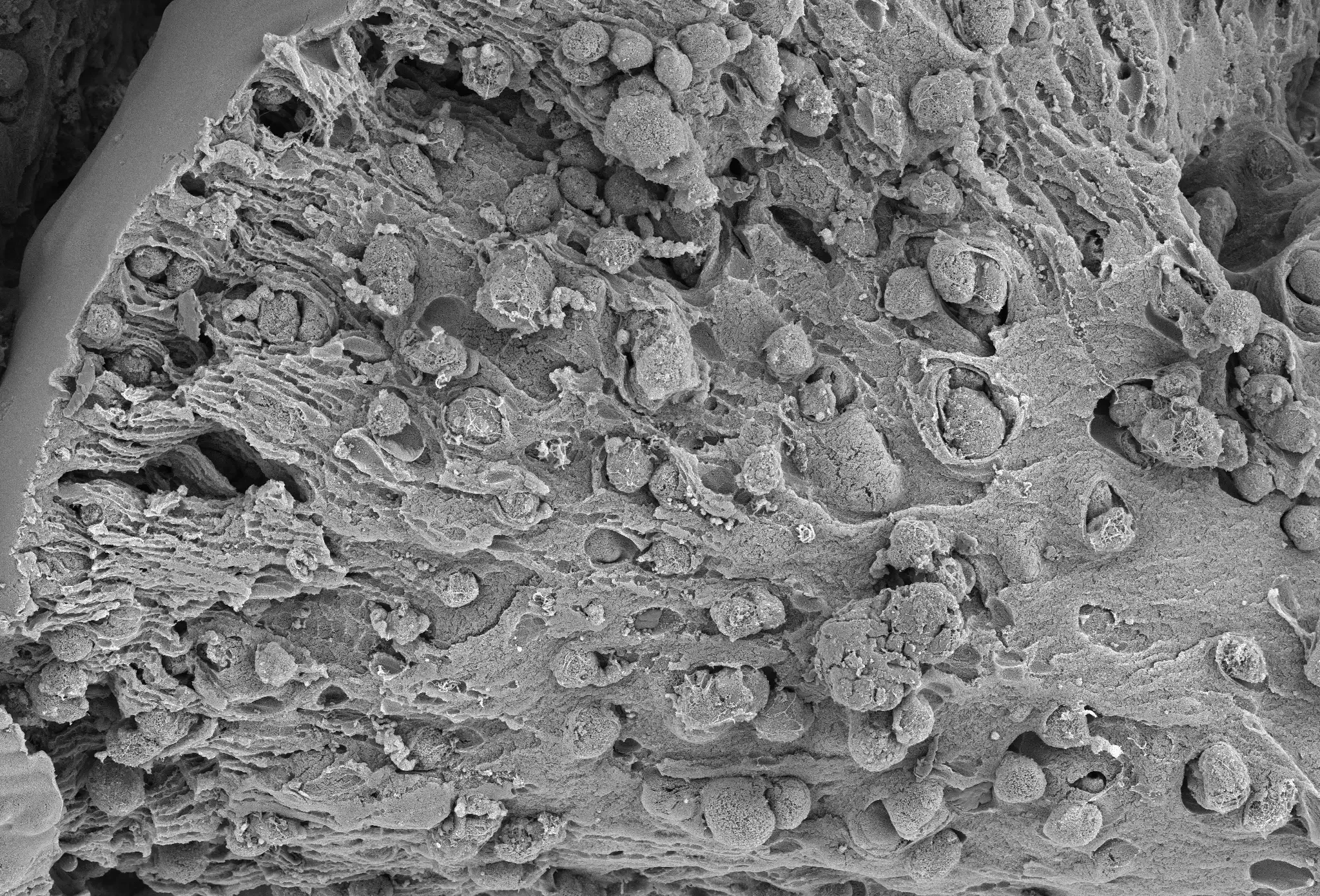 Microbead-cross-section-with-encapsulated-cells-whitebar | Gameto