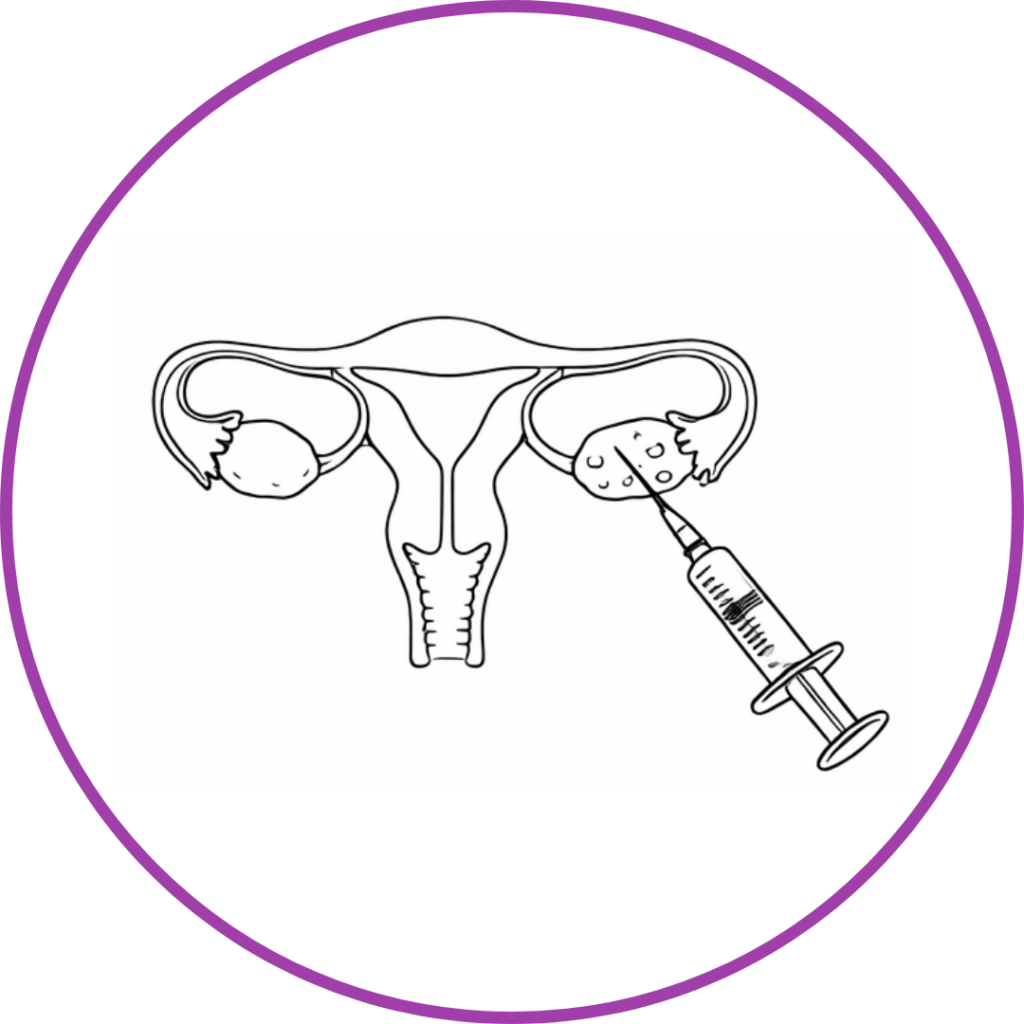 Ovarian stimulation through hormone injection in the IVF process.